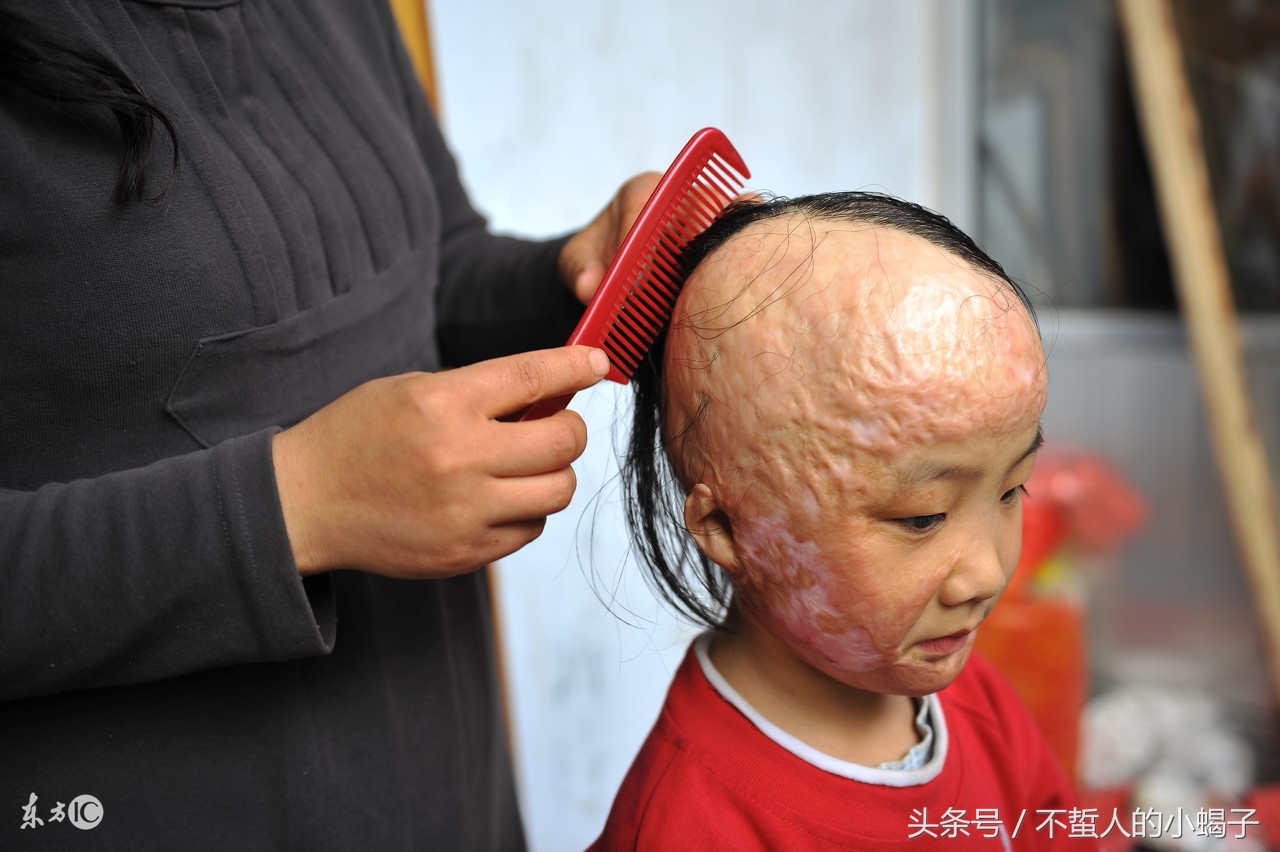 真是痛心！细心做好这些，别等孩子没命了再悔恨终生