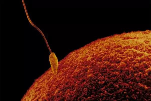 多个卵泡会导致不孕吗,多卵泡医生不建议备孕