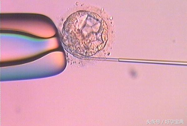 什么叫促排卵呢,促排卵是自然受孕吗