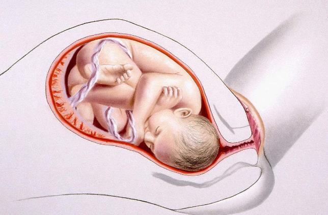 孕期先兆流产有哪些症状,孕期有先兆流产症状要注意哪些