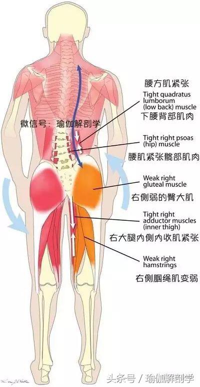 骨盆歪斜导致小便歪,足外翻导致骨盆歪斜