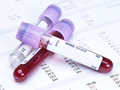 10秒看懂血常规报告单,三分钟教你看血常规