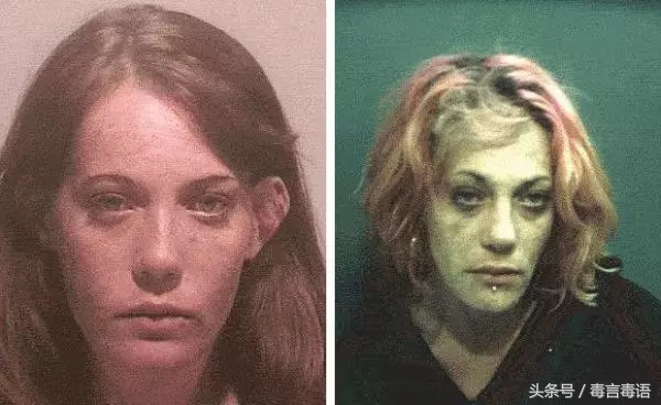 吸毒前后的变化对比,吸毒真的会毁容吗