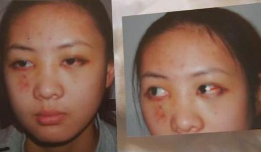 张默打童瑶事件立案了吗,张默暴打童瑶事件后续