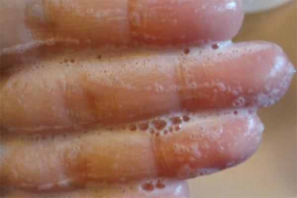 t字区太黑怎么调整,如何改善t字区暗沉发黄