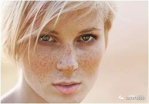 色斑形成的原因及淡化方法，摆脱色斑肌肤困扰