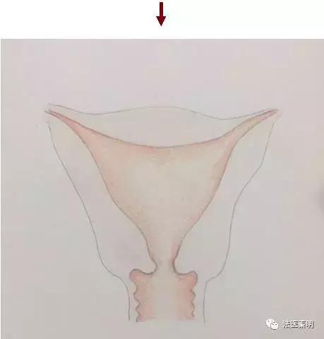 女人有两个子宫怎么办呢,来大姨妈可以同宫吗