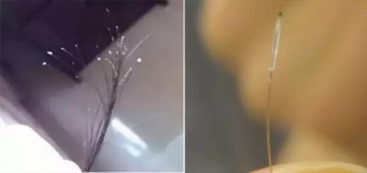 总是担心自己要秃了,怀疑自己越来越秃