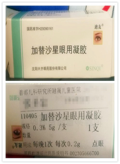 宝宝眼睛红,儿研所50元挂号1分钟诊断,药到病除,附就诊攻略