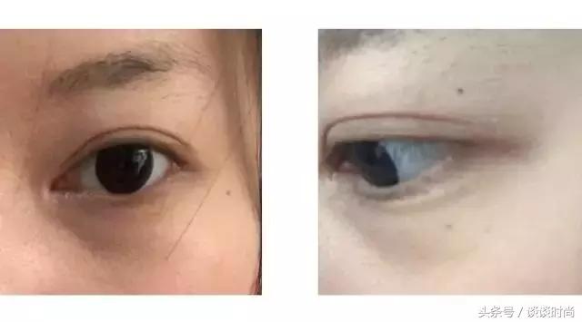 遮黑眼圈泪沟快速教程,新手如何遮泪沟黑眼圈