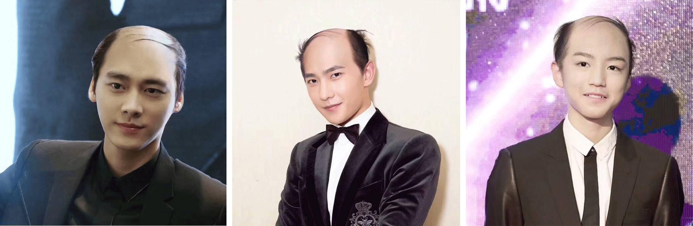 美颜相机都遮不住皱纹了,美颜相机美颜总掉怎么回事