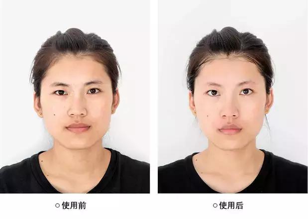 激光脱毛真的可以永久脱毛吗男士,360激光脱毛和冰点脱毛有什么区别