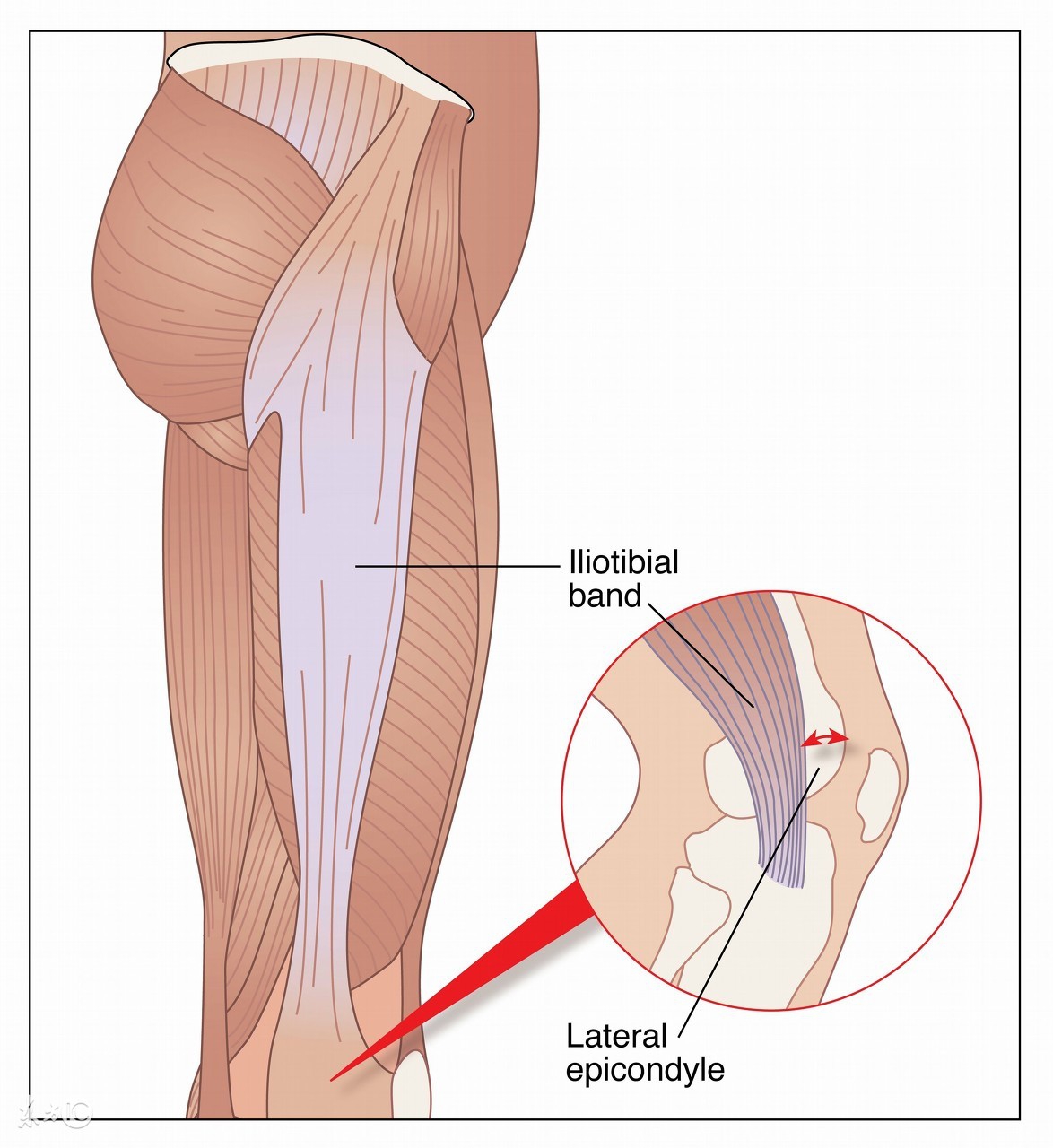 McCuneAlbright综合症,McCuneAlbright综合征