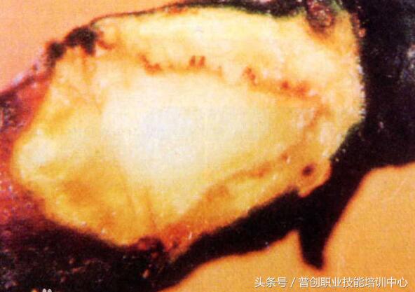 苹果缩果病与病毒病区别,苹果缩果的原因