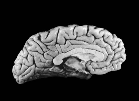爱因斯坦大脑和平常人大脑对比,爱因斯坦大脑与众不同的奥秘所在