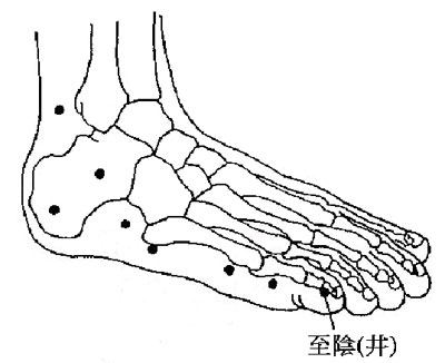 产检胎位横位怎么快速纠正,刚发现怀孕胎位不正怎么纠正最快