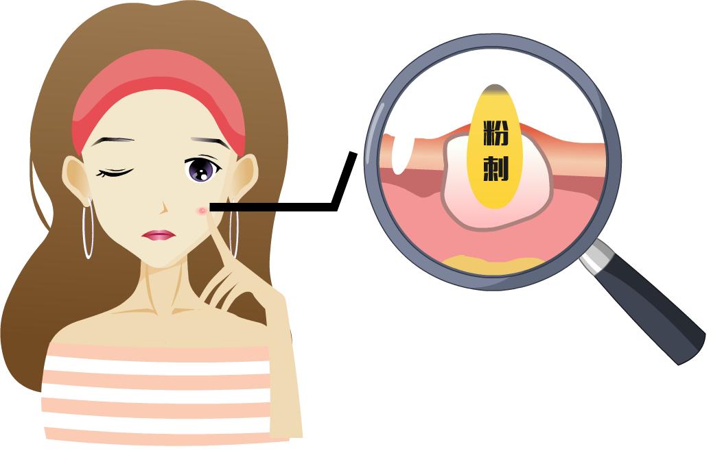 分享自用防止不再长痘的秘籍,正确战痘第一步认清痘痘真面目