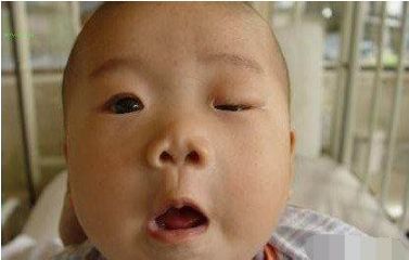 两岁宝宝眼睛一睁一闭,2岁左右宝宝怎么呵护眼睛