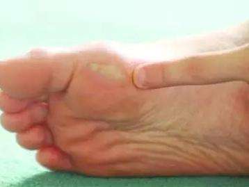 跑步水泡快速消除,跑步磨出水泡如何快速恢复