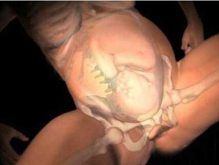 为什么生孩子这么疼女人都不怕,两分钟带你了解生孩子到底多痛