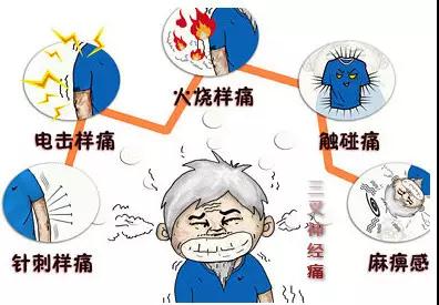 天下第一疼手术是什么,天下第一三叉神经减压术