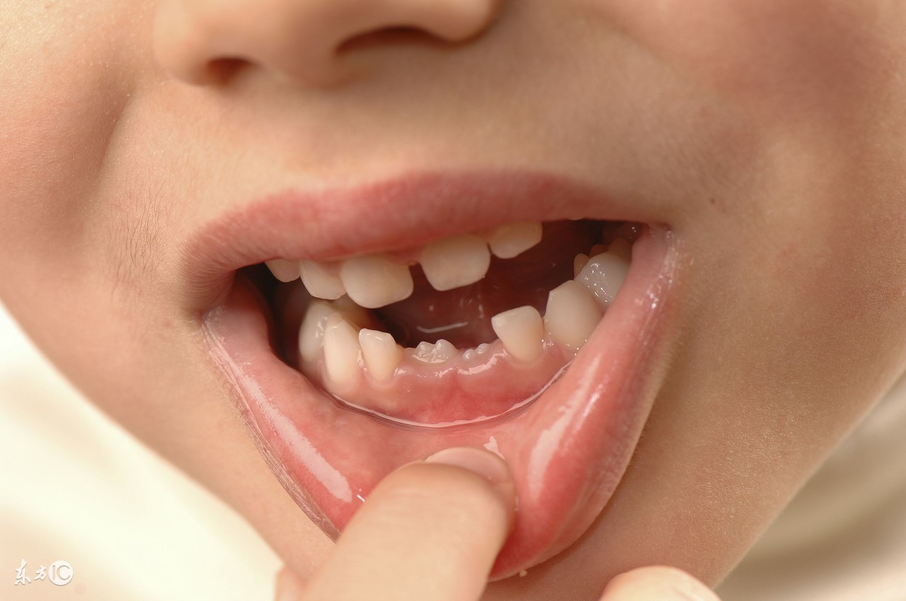 宝宝乳牙釉质发育不全怎么办,宝宝出牙期妈妈最易忽视护理细节