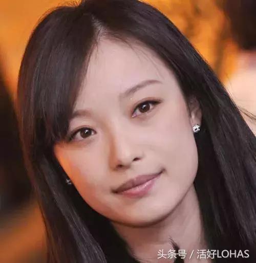 拯救发际线的生发神器,拯救发际线神器