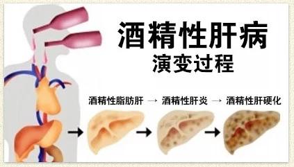 喜欢喝酒的人如何克服,喜欢喝酒的人饮食如何调理