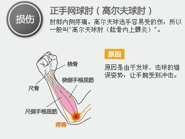 打高尔夫注意哪些事项,高尔夫对身体的伤害