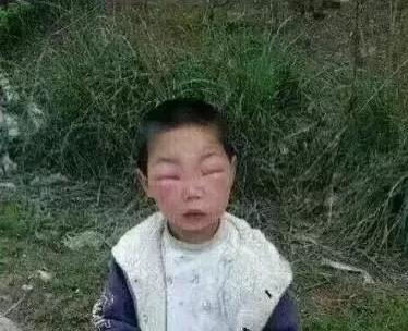 哈哈哈，原谅我拖拉机般的笑声！当喵星人被蜜蜂蜇了之后