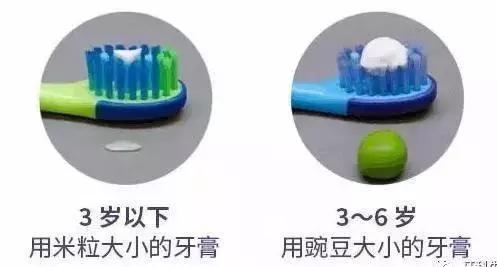 宝宝乳牙龋齿严重用拔牙不,孩子乳牙龋齿有必要补牙吗