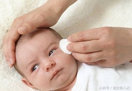 宝宝眼屎多解决办法视频,宝宝眼屎多需要通泪道吗