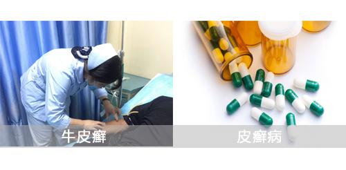 皮癣区分,皮癣和牛皮癣的区别