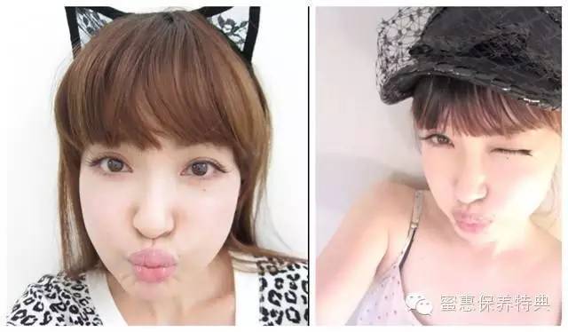 欧美阿姨PK日本大妈——差了10斤胶原蛋白！