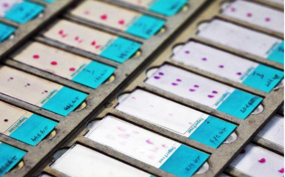 女孩因月经不调就诊，医生却让她切子宫？