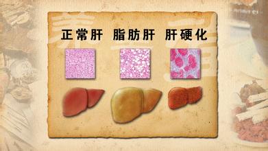 重视肝脏健康可以从日常小事做起,重视肝的健康