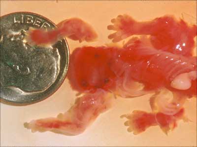 且行且珍惜！警惕头胎人流会带来5大危害