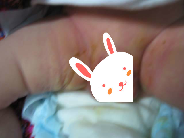 初生宝宝照蓝光十小时未归，见面的那一刻我哭了！