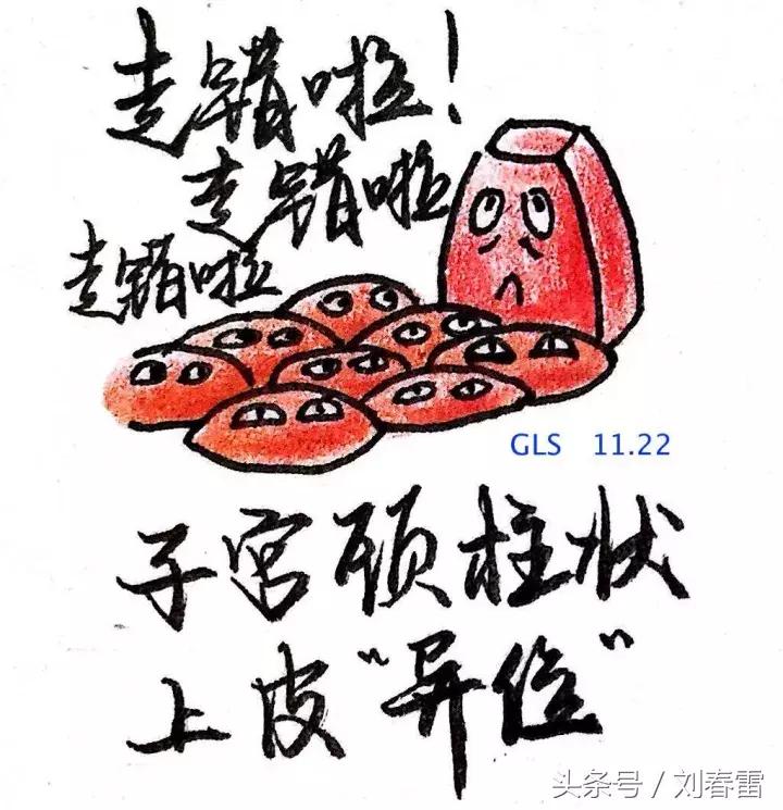 宫颈癌科普知识宣教视频,宫颈癌的科普知识宣传