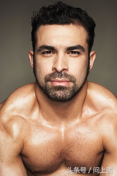 全身有体毛就是多毛症吗,病态性多毛症状