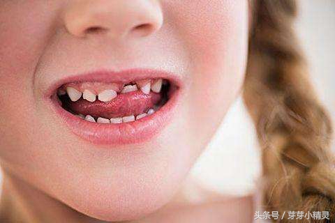 7岁孩子换牙容易出现不适问题,如何缓解大宝宝换牙期各种不适