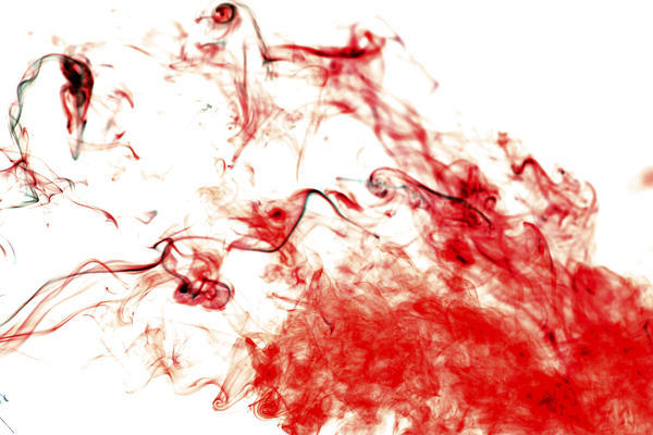 没来月经却有血是怎么了,为什么没来生理期内裤上却有血