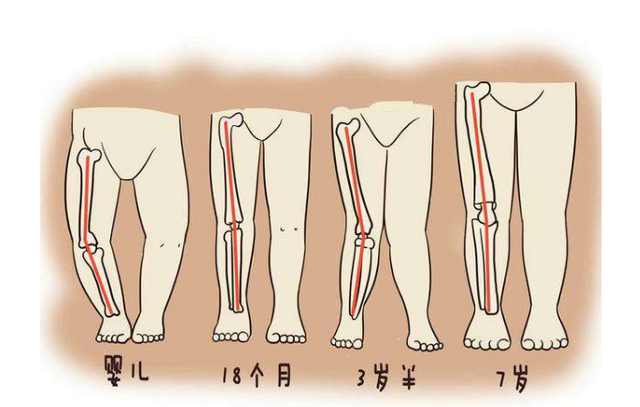 两岁宝宝o型腿内八字怎么办,宝宝x型腿或o型腿几岁能看出来