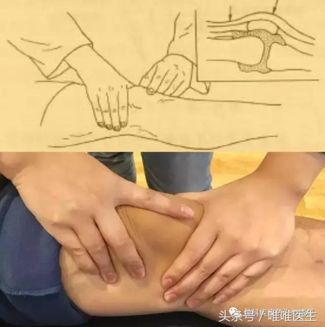 武汉骨科滑膜炎去哪里看最好,骨科专家滑膜炎是什么症状