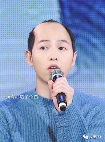 男生防止发际线后移的方法,男性怎样防止发际线后移