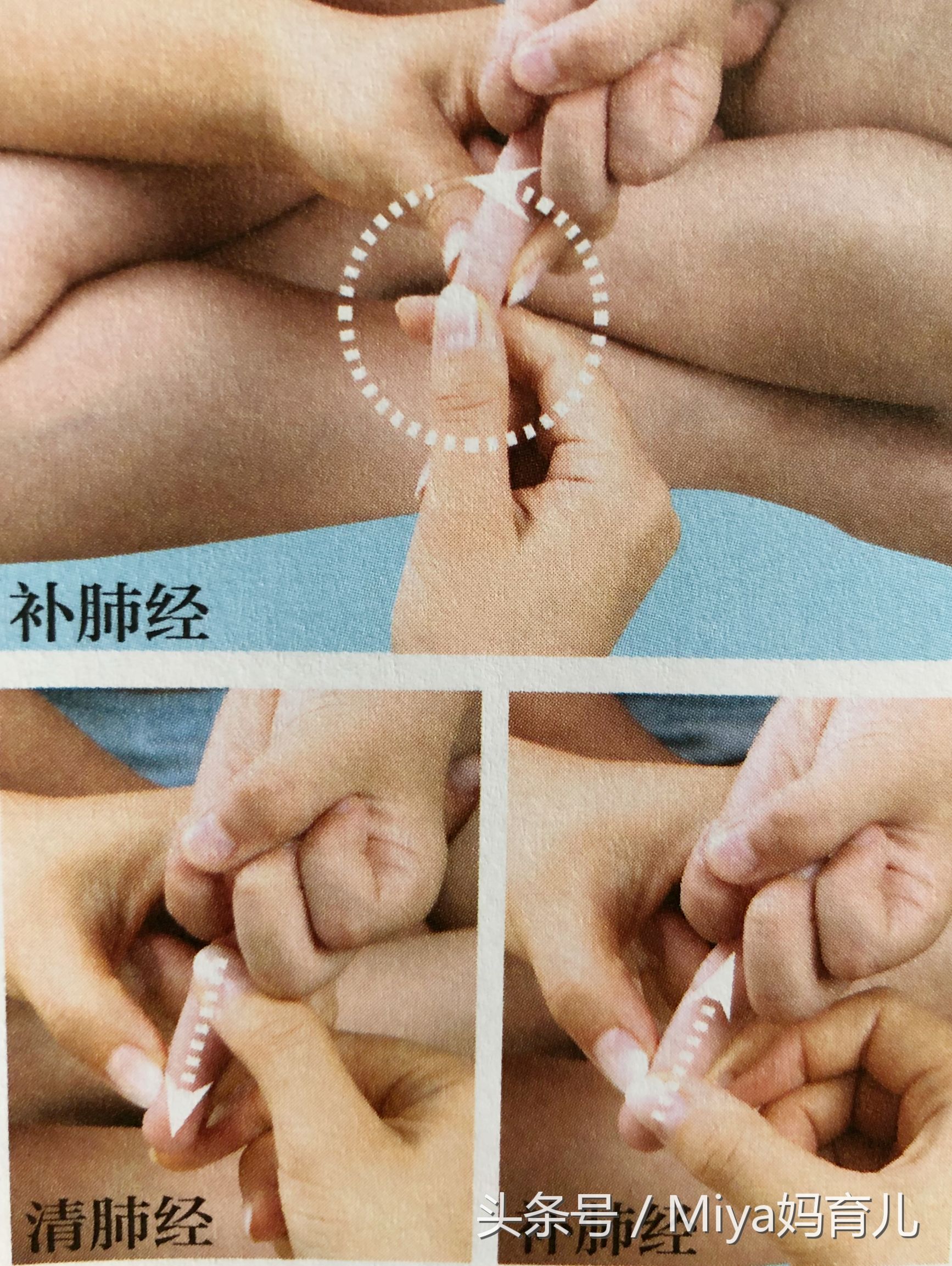 小儿推拿湿疹的调理,小儿推拿湿疹的正确手法视频