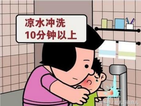 1岁婴儿被开水烫伤掉皮会留疤吗,宝宝烫伤怎么不留疤痕小妙招