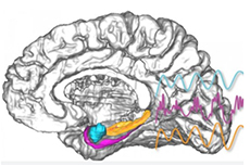 用电刺激大脑可增强记忆，有助治疗帕金森病等病症