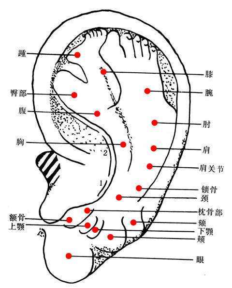 骨折扭伤的处理步骤,讲解骨折扭伤要怎么调养