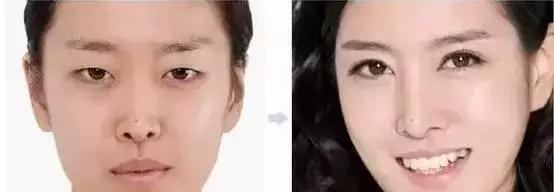 纹眉后有啥注意事项,纹眉后注意事项要用修复精华吗